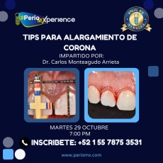 Tips para Alargamiento de corona